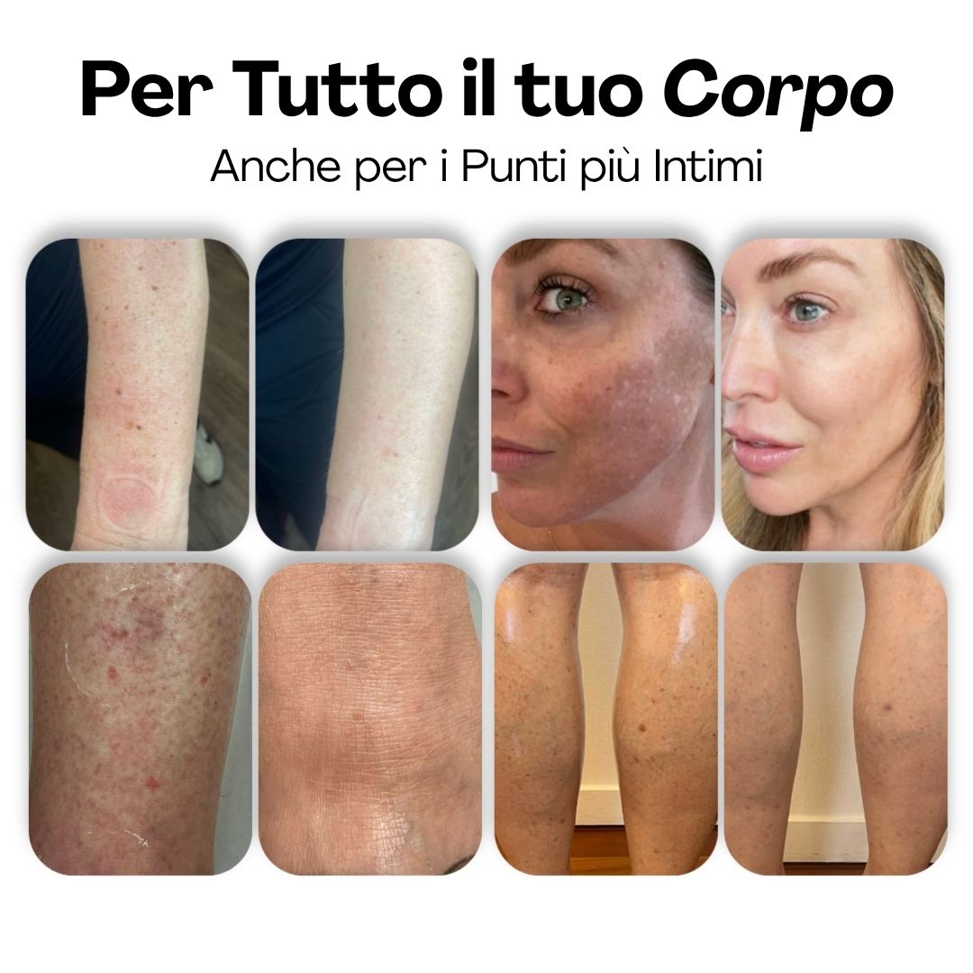 Sapone Anti Macchie Effetto Ringiovanente di Silvea®